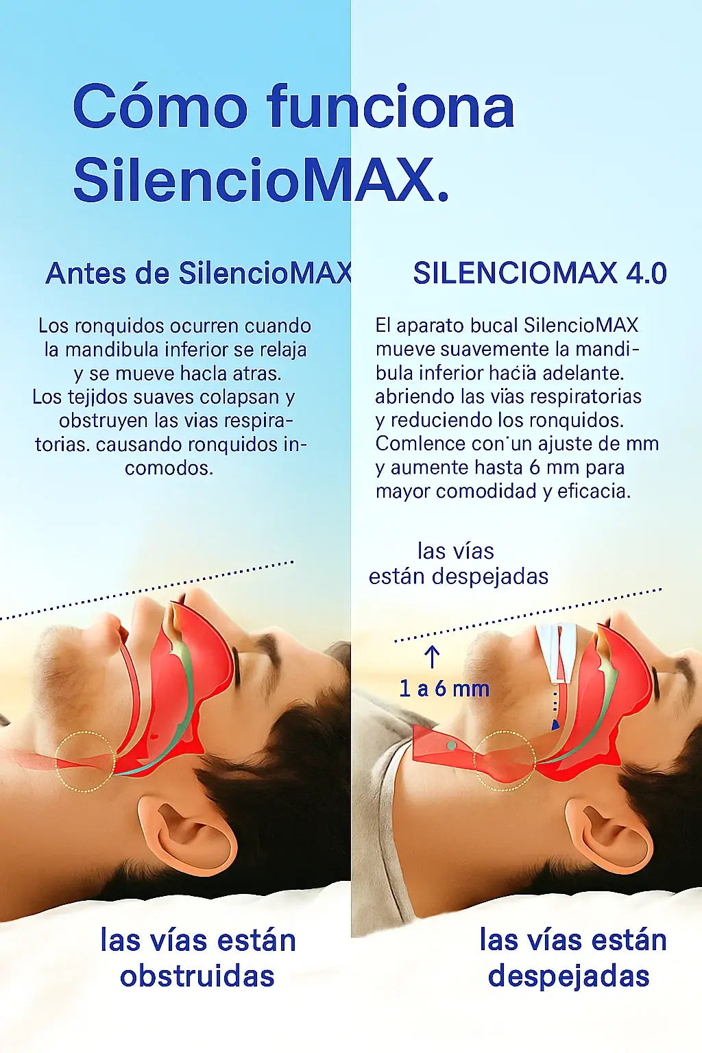Silencio MAX Anti-Ronquidos